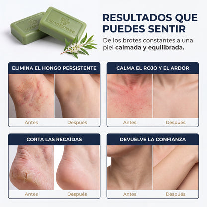 Elimina los Hongos de Raíz y Protege Tu Piel